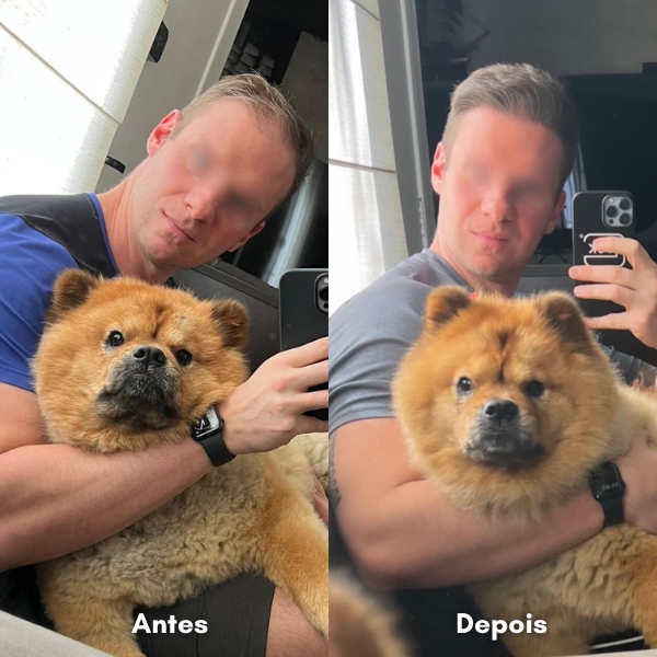 Antes e depois de transplante capilar