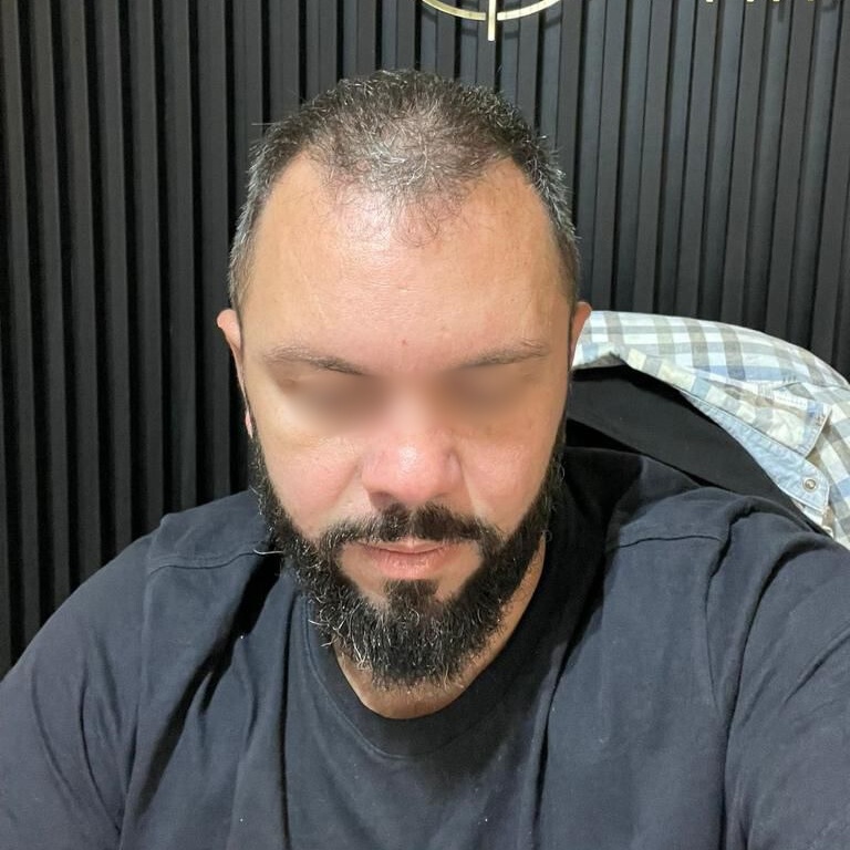 40e2df90-8386-48ca-8da7-fcef39dabf1e